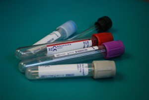 What blood tests should you request from your Doctor?